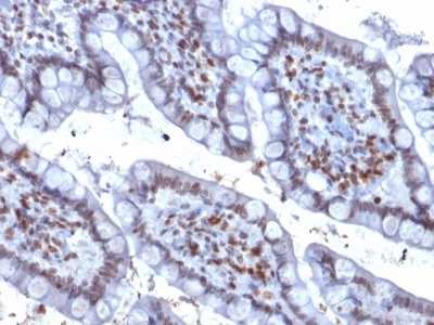 Immunohistochemistry (Formalin/PFA-fixed paraffin-embedded sections) - Anti-PU.1/Spi1 antibody [PU1/2146] (AB238054), expandable thumbnail