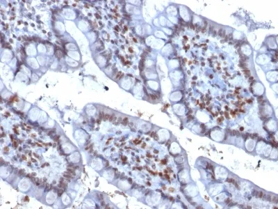 Immunohistochemistry (Formalin/PFA-fixed paraffin-embedded sections) - Anti-PU.1/Spi1 antibody [PU1/2146] (AB238054)