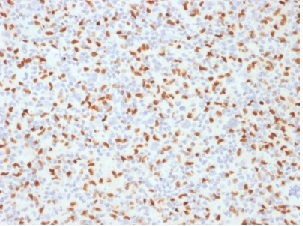 Immunohistochemistry (Formalin/PFA-fixed paraffin-embedded sections) - Anti-PU.1/Spi1 antibody [PU1/2146] (AB238054), expandable thumbnail