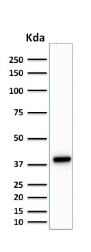 Western blot - Anti-PU.1/Spi1 antibody [PU1/2146] (ab238054), expandable thumbnail