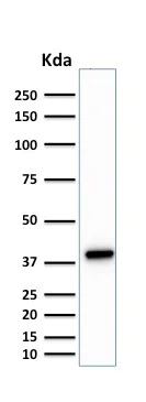 Western blot - Anti-PU.1/Spi1 antibody [PU1/2146] (AB238054)