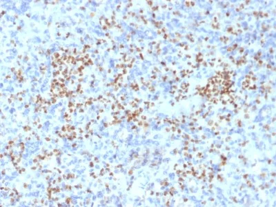 Immunohistochemistry (Formalin/PFA-fixed paraffin-embedded sections) - Anti-PU.1/Spi1 antibody [PU1/2146] - BSA and Azide free (AB237905)