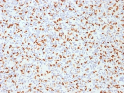 Immunohistochemistry (Formalin/PFA-fixed paraffin-embedded sections) - Anti-PU.1/Spi1 antibody [PU1/2146] - BSA and Azide free (AB237905), expandable thumbnail