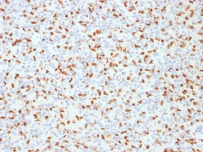 Immunohistochemistry (Formalin/PFA-fixed paraffin-embedded sections) - Anti-PU.1/Spi1 antibody [PU1/2146] - BSA and Azide free (AB237905)