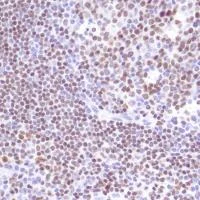 Immunohistochemistry (Formalin/PFA-fixed paraffin-embedded sections) - Anti-PU.1/Spi1 antibody [SP238] (AB183327)