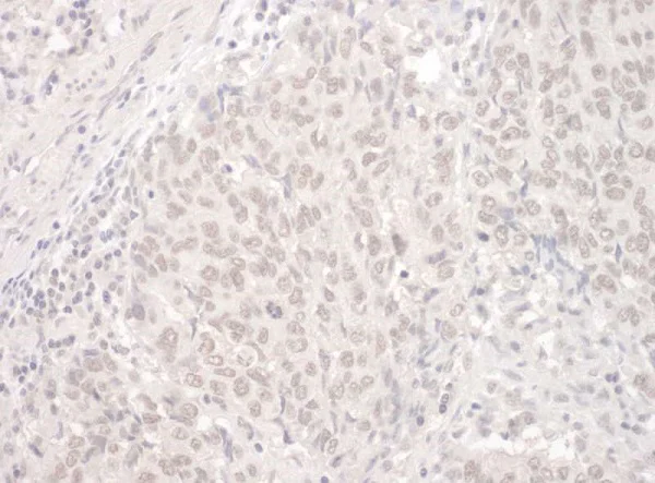 Immunohistochemistry (Formalin/PFA-fixed paraffin-embedded sections) - Anti-PUF60/FIR antibody (AB225705)