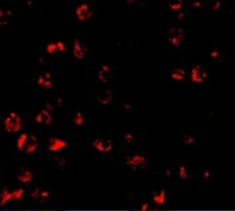 Immunocytochemistry/ Immunofluorescence - Anti-PUMA antibody (AB9645)