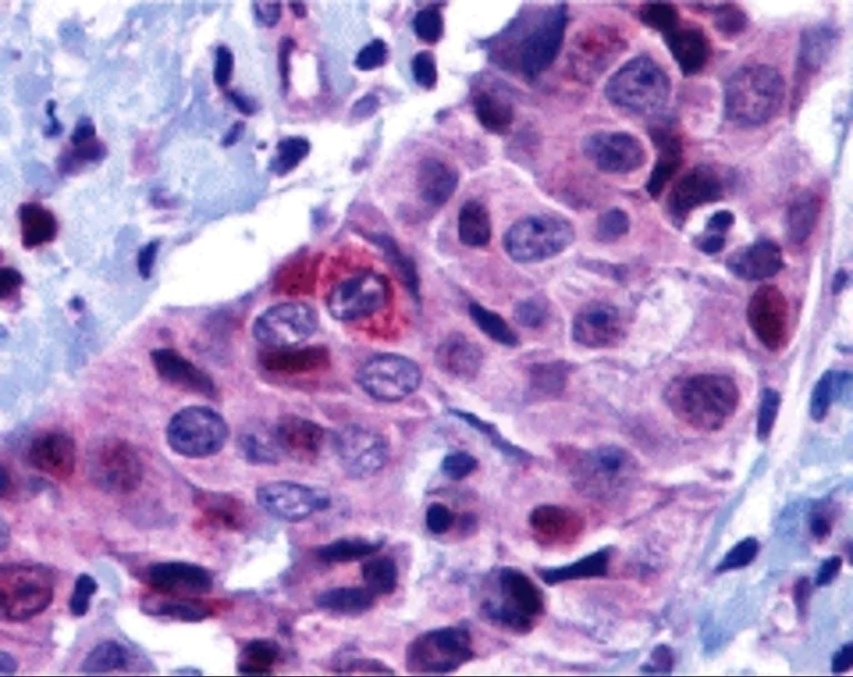Immunohistochemistry (Formalin/PFA-fixed paraffin-embedded sections) - Anti-PUMA antibody (AB9645)