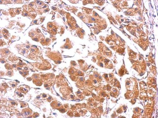 Immunohistochemistry (Formalin/PFA-fixed paraffin-embedded sections) - Anti-PUMA antibody - C-terminal (AB227130)
