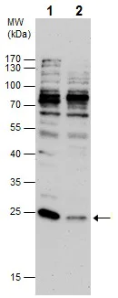 Western blot - Anti-PUMA antibody - C-terminal (AB227130)