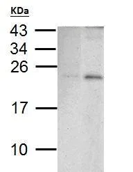 Western blot - Anti-PUMA antibody - C-terminal (AB227130)