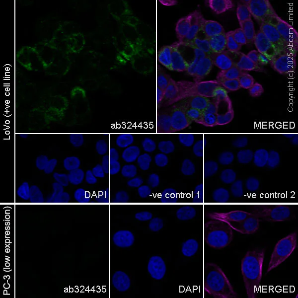 Immunocytochemistry/ Immunofluorescence - Anti-PUMA antibody [EPR26854-239] (AB324435)