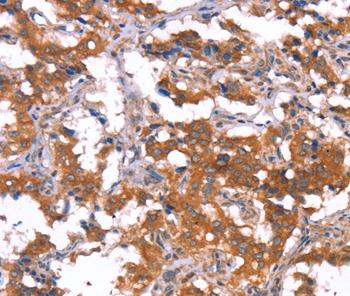 Immunohistochemistry (Formalin/PFA-fixed paraffin-embedded sections) - Anti-Puma gamma/GPR109A antibody (AB198693), expandable thumbnail