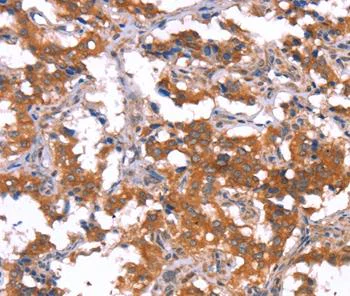 Immunohistochemistry (Formalin/PFA-fixed paraffin-embedded sections) - Anti-Puma gamma/GPR109A antibody (AB198693)