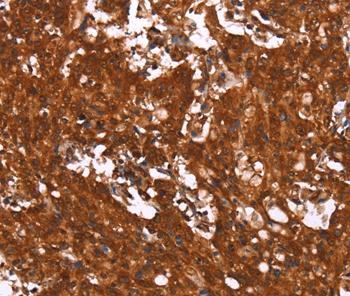 Immunohistochemistry (Formalin/PFA-fixed paraffin-embedded sections) - Anti-Puma gamma/GPR109A antibody (AB198693), expandable thumbnail