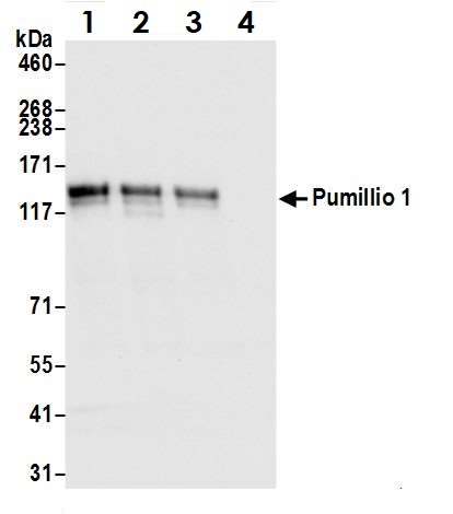 Immunoprecipitation - Anti-Pumilio 1 antibody (AB3717), expandable thumbnail