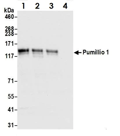 Immunoprecipitation - Anti-Pumilio 1 antibody (AB3717)