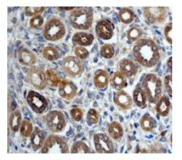 Immunohistochemistry (Formalin/PFA-fixed paraffin-embedded sections) - Anti-Pumilio 1 antibody [EPR3795] (AB92545), expandable thumbnail