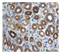 Immunohistochemistry (Formalin/PFA-fixed paraffin-embedded sections) - Anti-Pumilio 1 antibody [EPR3795] (AB92545)