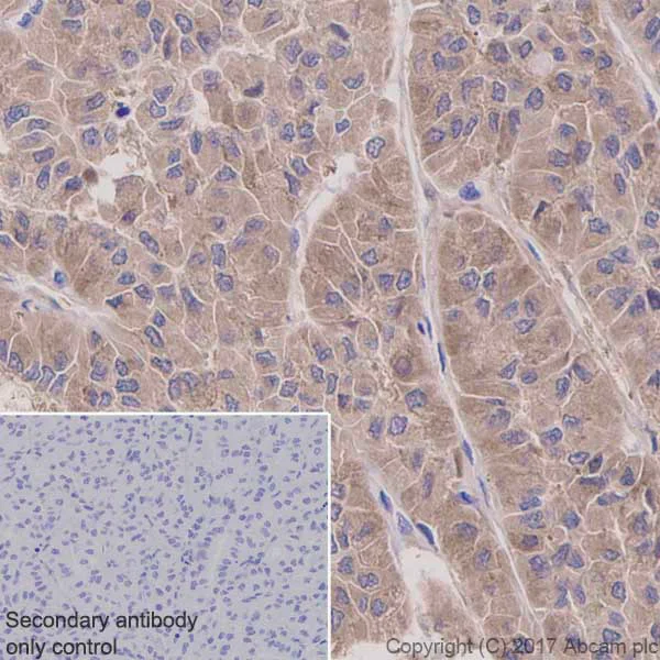Pumilio 1 (B7) Rabbit mAb main image 1