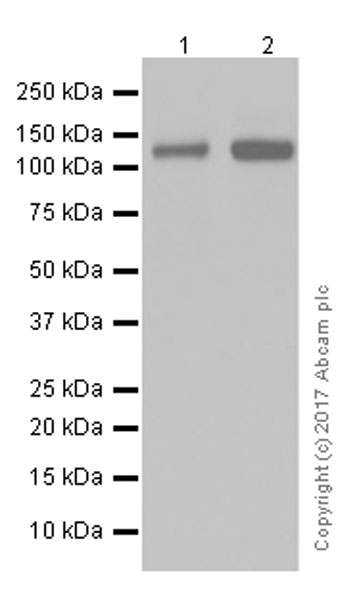 Western blot - Anti-Pumilio 1 antibody [EPR3795] (AB92545), expandable thumbnail
