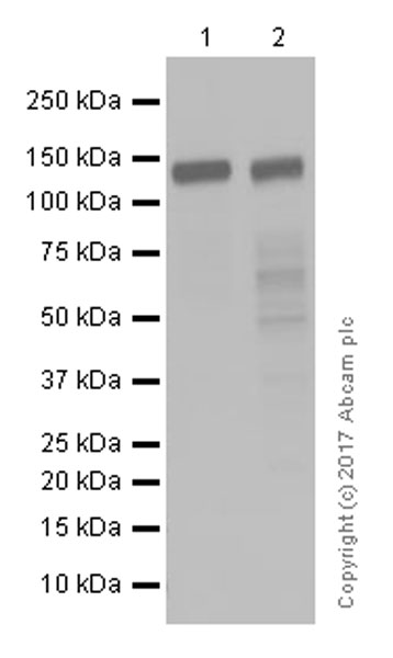 Western blot - Anti-Pumilio 1 antibody [EPR3795] (ab92545), expandable thumbnail