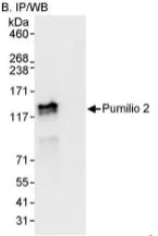 Immunoprecipitation - Anti-Pumilio 2 antibody (AB10361)