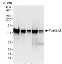 Western blot - Anti-Pumilio 2 antibody (AB10361)