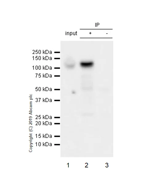 Immunoprecipitation - Anti-Pumilio 2 antibody [EPR3813] (AB92390)