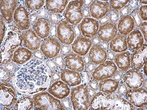 Immunohistochemistry (Formalin/PFA-fixed paraffin-embedded sections) - Anti-Pumilio 2 antibody - N-terminal (AB228743)