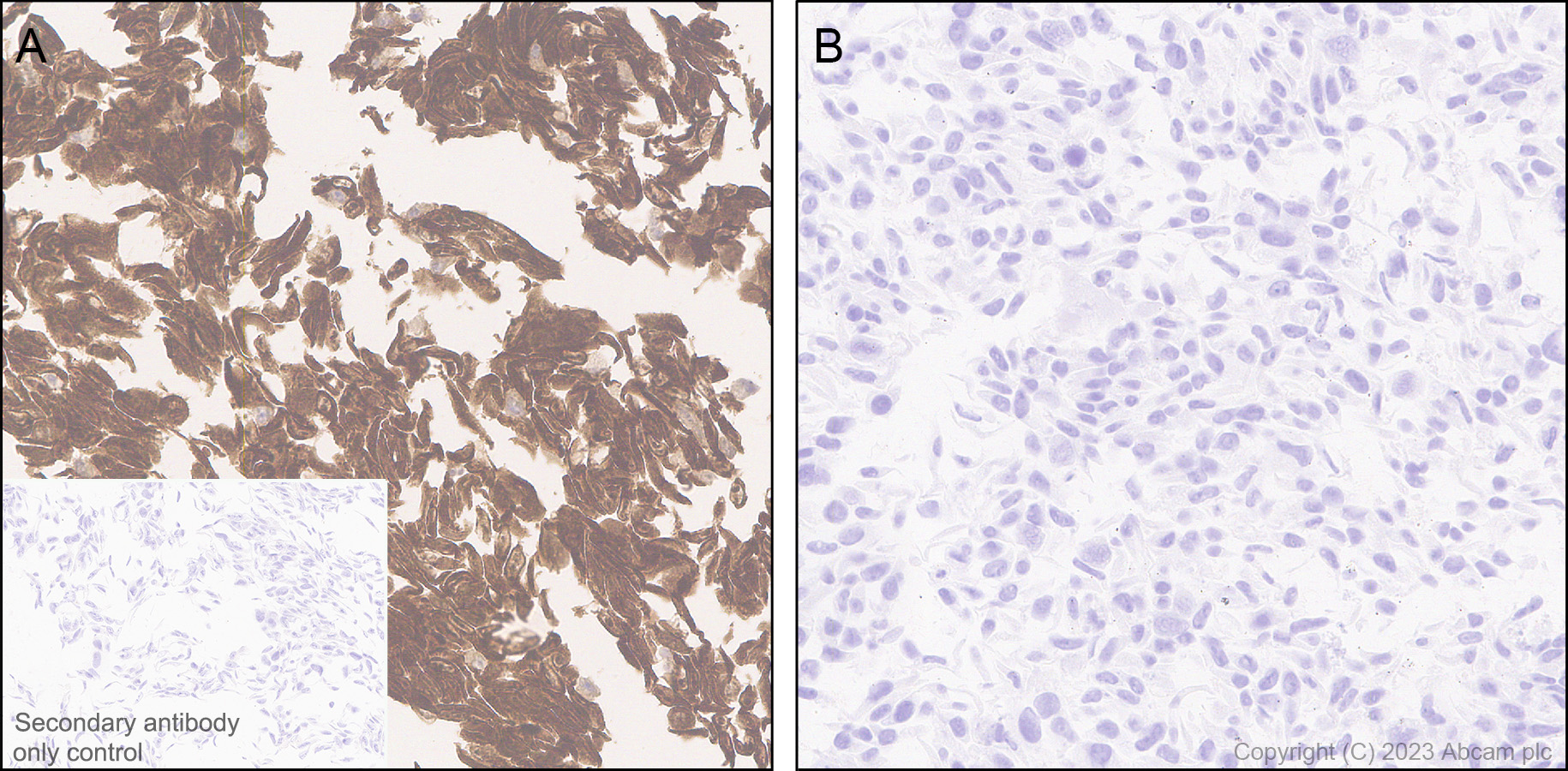 Immunohistochemistry (Formalin/PFA-fixed paraffin-embedded sections) - Anti-Puromycin antibody [EPR27218-173] (AB315887), expandable thumbnail
