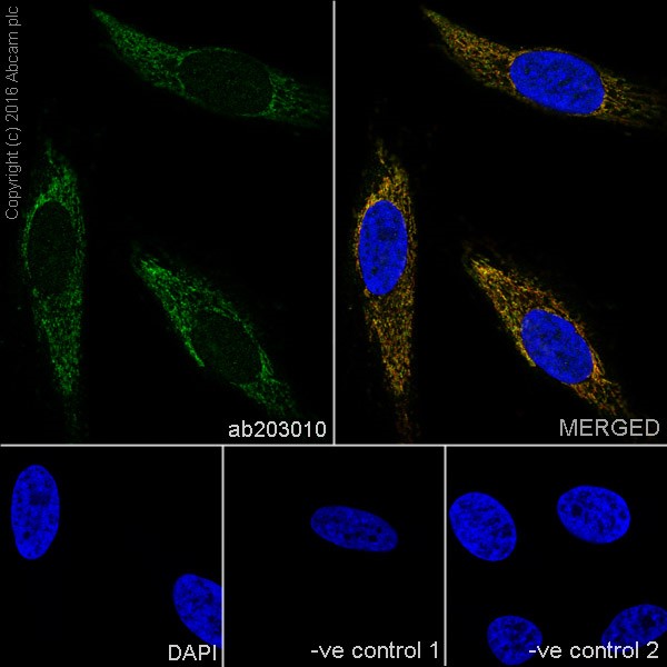 Immunocytochemistry/ Immunofluorescence - Anti-PUS1 antibody [EPR20181] (AB203010), expandable thumbnail