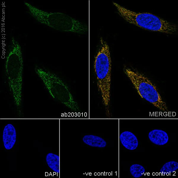 Immunocytochemistry/ Immunofluorescence - Anti-PUS1 antibody [EPR20181] (AB203010)