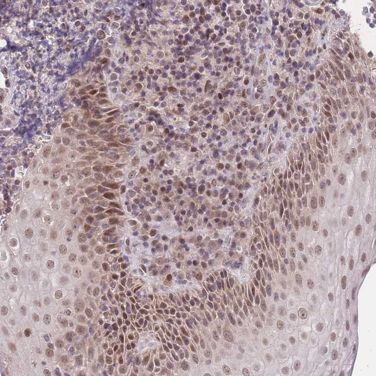 Immunohistochemistry (Formalin/PFA-fixed paraffin-embedded sections) - Anti-PUS10 antibody (AB185078)