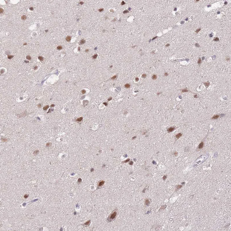 Immunohistochemistry (Formalin/PFA-fixed paraffin-embedded sections) - Anti-PUS10 antibody (AB185078)