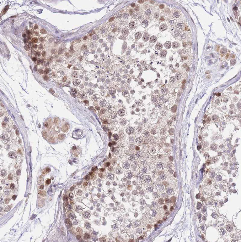 Immunohistochemistry (Formalin/PFA-fixed paraffin-embedded sections) - Anti-PUS10 antibody (AB185078)