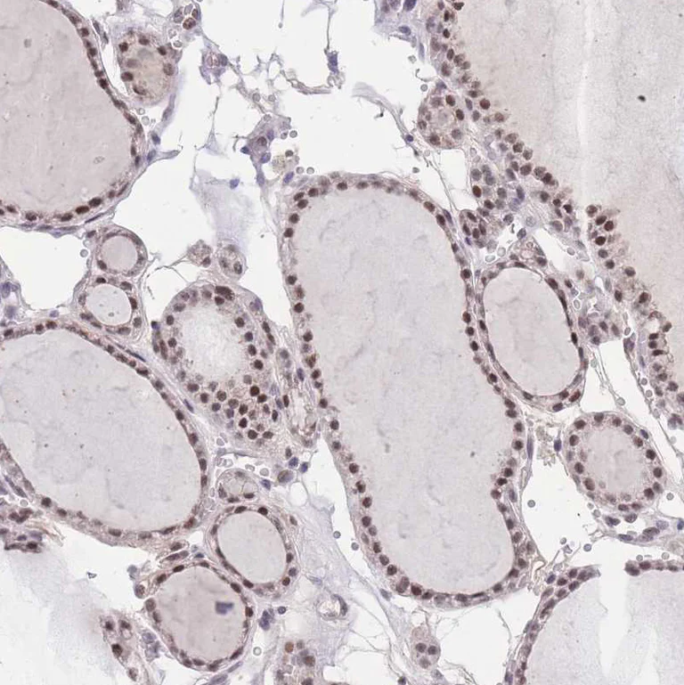 Immunohistochemistry (Formalin/PFA-fixed paraffin-embedded sections) - Anti-PUS10 antibody (AB185078)