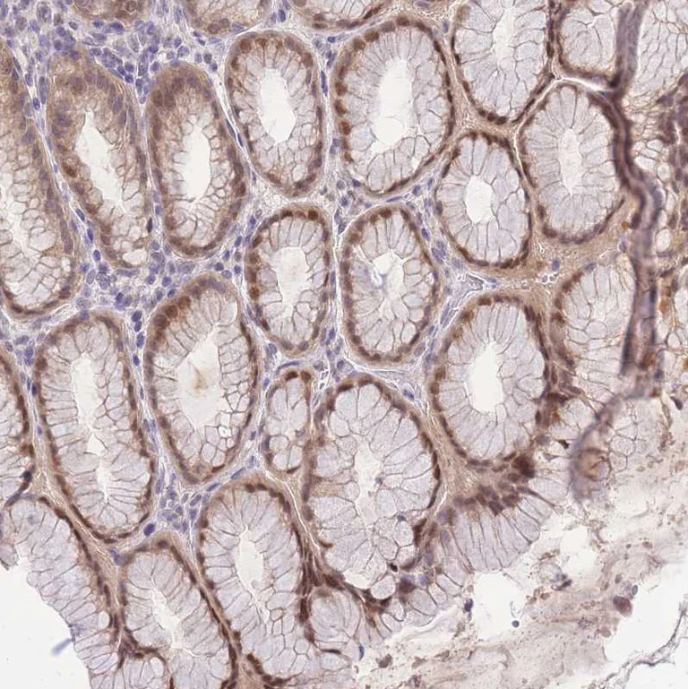 Immunohistochemistry (Formalin/PFA-fixed paraffin-embedded sections) - Anti-PUS10 antibody (AB185078)