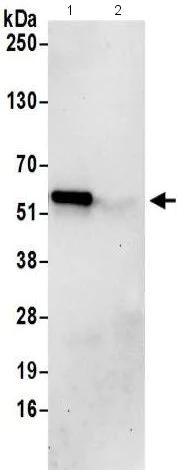 Immunoprecipitation - Anti-PUS3 antibody - C-terminal (AB211270)
