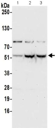 Western blot - Anti-PUS3 antibody - C-terminal (AB211270)