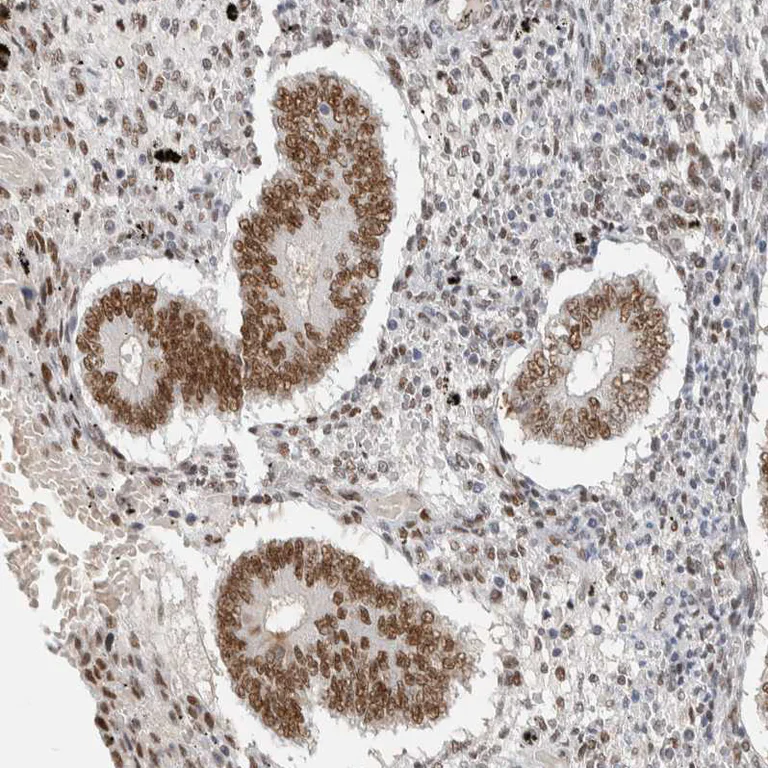 Immunohistochemistry (Formalin/PFA-fixed paraffin-embedded sections) - Anti-PUS7 antibody (AB224119)