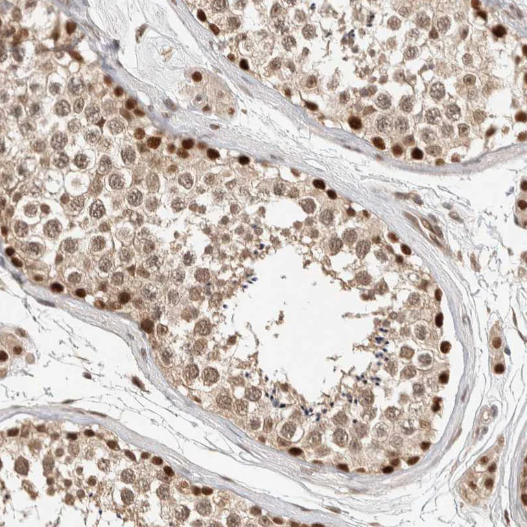 Immunohistochemistry (Formalin/PFA-fixed paraffin-embedded sections) - Anti-PUS7 antibody (AB224119)