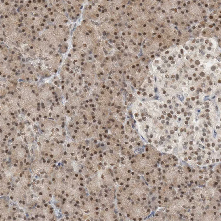 Immunohistochemistry (Formalin/PFA-fixed paraffin-embedded sections) - Anti-PUS7 antibody (AB224119)