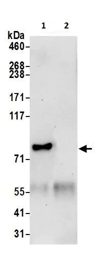 Immunoprecipitation - Anti-PUS7 antibody (AB226245)