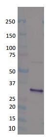 Western blot - Anti-PVL LukS antibody (AB190473), expandable thumbnail