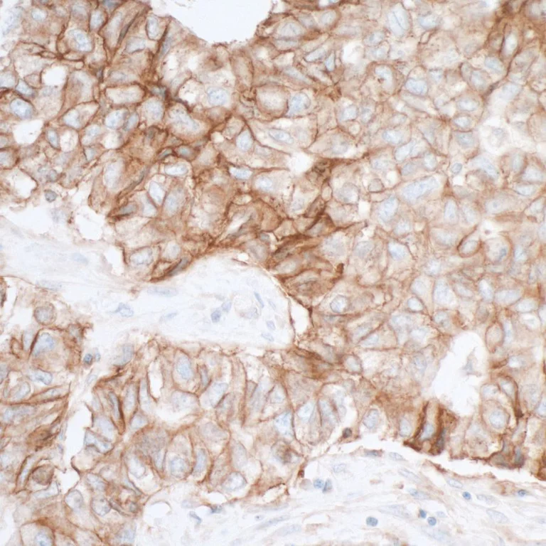Immunohistochemistry (Formalin/PFA-fixed paraffin-embedded sections) - Anti-PVR/CD155 antibody [BLR074G] - BSA free (AB314064)