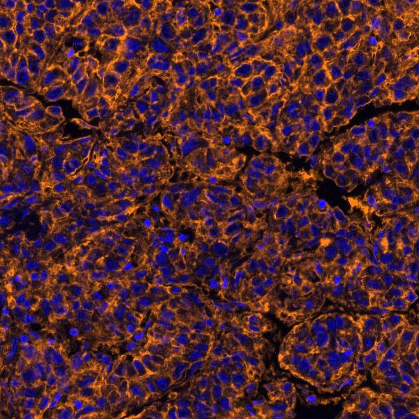 Immunohistochemistry (Formalin/PFA-fixed paraffin-embedded sections) - Anti-PVR/CD155 antibody [BLR074G] - BSA free (AB314064)