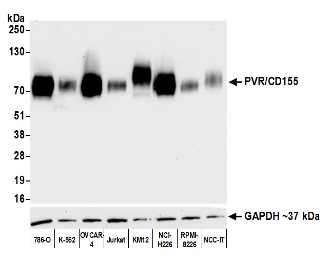 Western blot - Anti-PVR/CD155 antibody [BLR074G] - BSA free (AB314064)