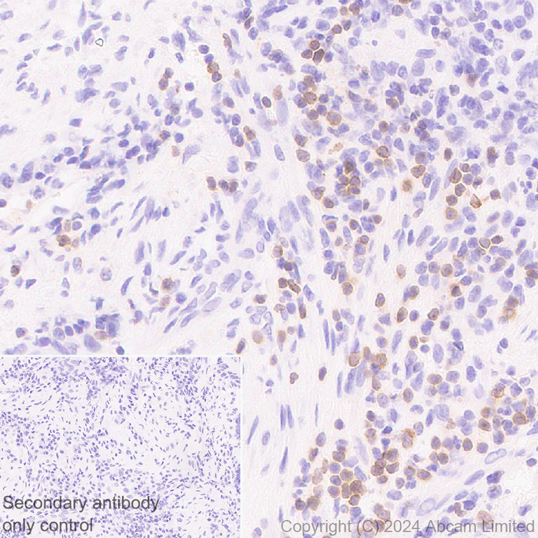 Immunohistochemistry (Formalin/PFA-fixed paraffin-embedded sections) - Anti-PVRIG/CD112R antibody [EPR29052-91] (AB322348)