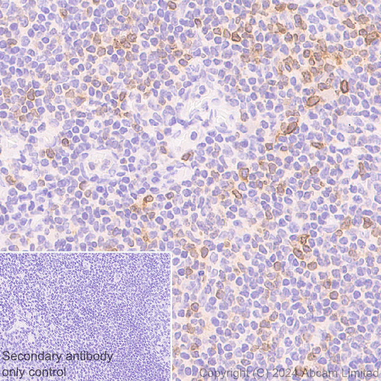 Immunohistochemistry (Formalin/PFA-fixed paraffin-embedded sections) - Anti-PVRIG/CD112R antibody [EPR29052-91] (AB322348)